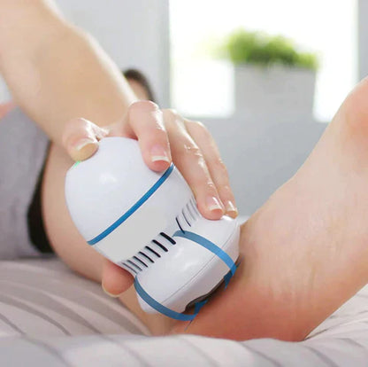 Veloura Vacuum Callus Remover