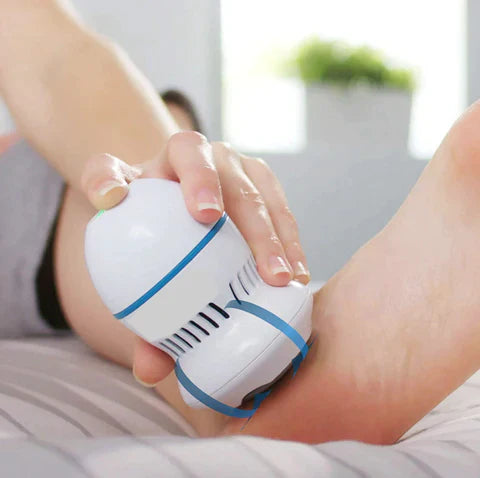 Veloura electric callus remover